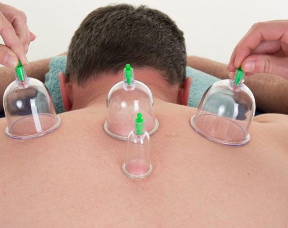 Akupunktur dan Bekam untuk Kanker: Dukungan Terapi Tradisional untuk Pasien